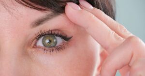 eyelid surgery Chico